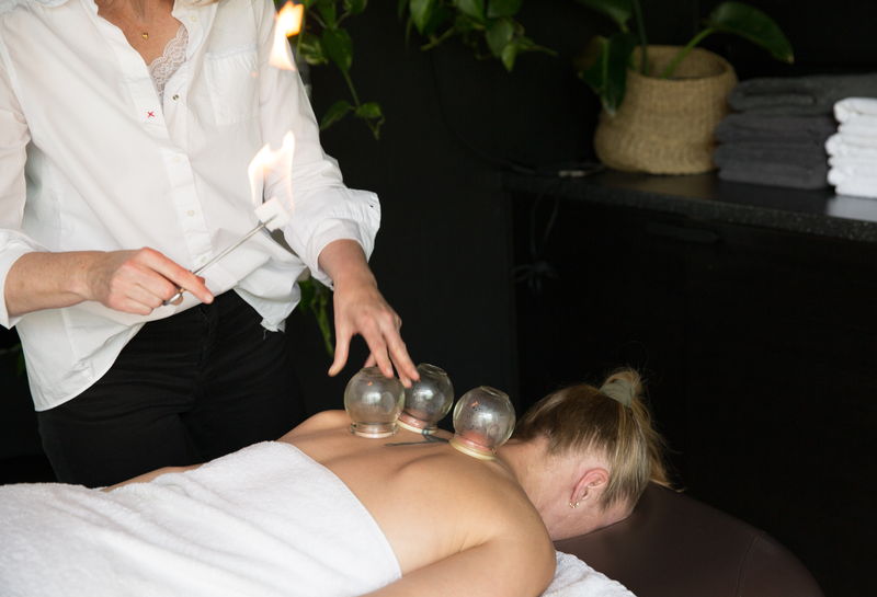 Tracy Limbrick applying fire cupping to a patient's upper back